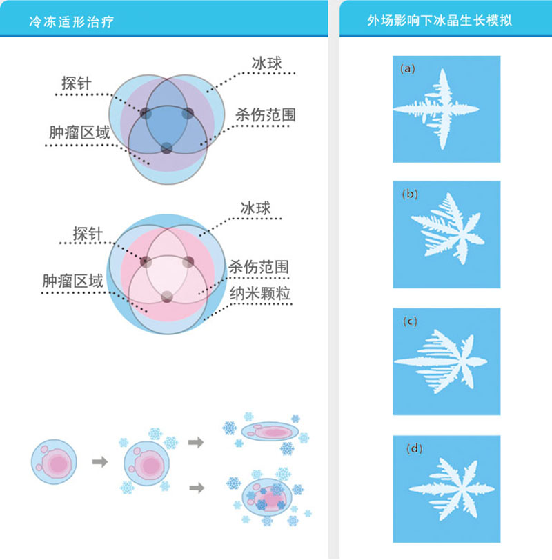 低温冷冻治疗系统2.jpg